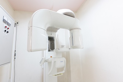歯科用CTを活用して安全に抜歯します